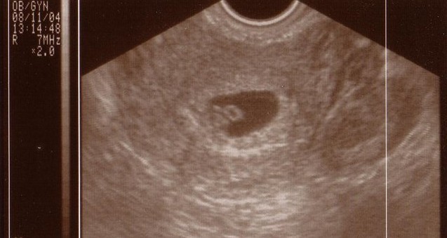 Image 4 of 4  -  51 kB